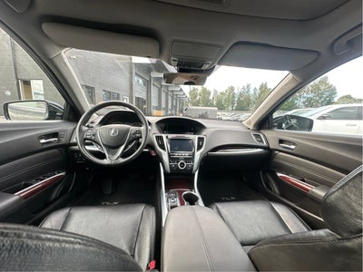 2015 Acura TLX V6 Tech
